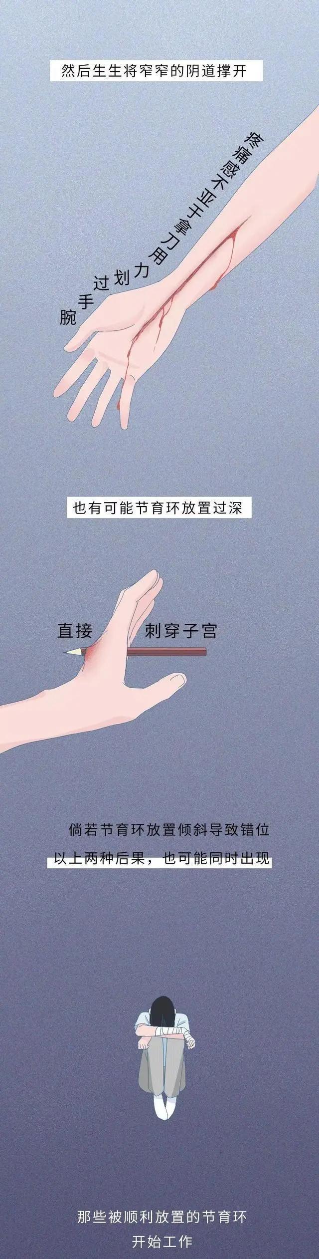 777778888澳门王中王2024年,漫画科普：“节育环”在女性体内的20年的历程，看完你会心酸吗？  第4张