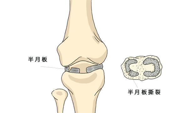 澳门天天开奖资料大全最新_跑步“跑出一生病”？想要跑步不伤身体，做到“六点”跑出健康  第3张